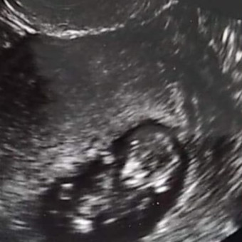 Babylist Registry Photo.