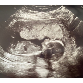 Babylist Registry Photo.