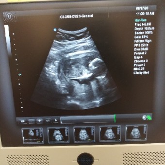 Babylist Registry Photo.