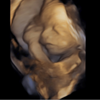 Babylist Registry Photo.