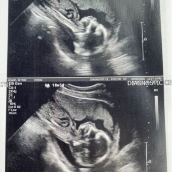 Babylist Registry Photo.