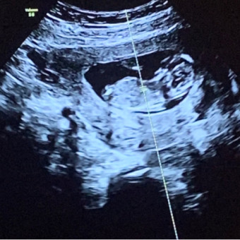 Babylist Registry Photo.