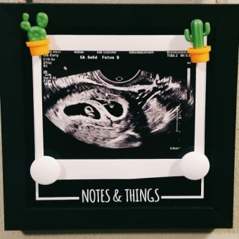 crocodile baby registry