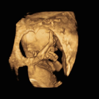 Babylist Registry Photo.
