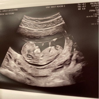 Babylist Registry Photo.