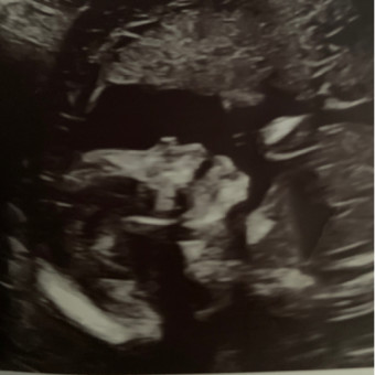 Babylist Registry Photo.
