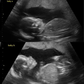 Babylist Registry Photo.