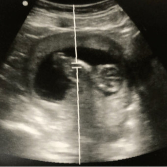 Babylist Registry Photo.