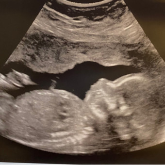 Babylist Registry Photo.