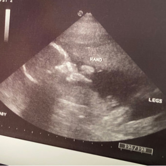 Babylist Registry Photo.