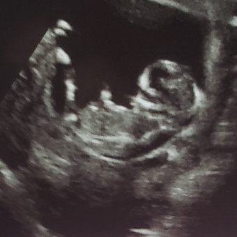 Babylist Registry Photo.