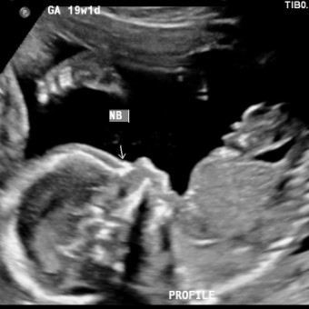 Babylist Registry Photo.