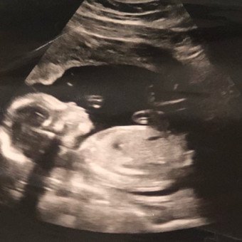 Babylist Registry Photo.