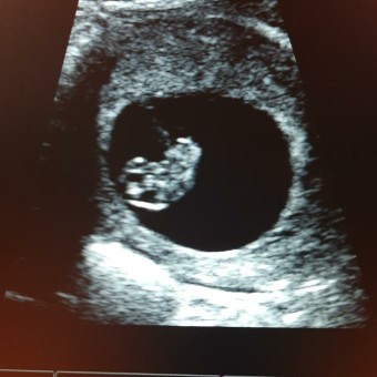 Babylist Registry Photo.