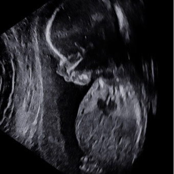 Babylist Registry Photo.