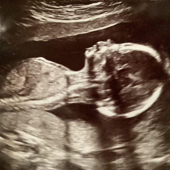 Babylist Registry Photo.
