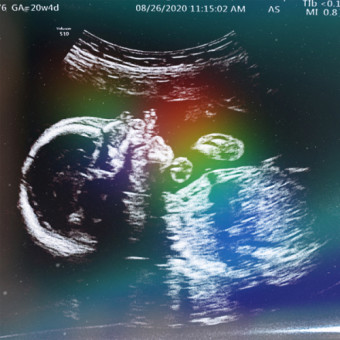 Babylist Registry Photo.