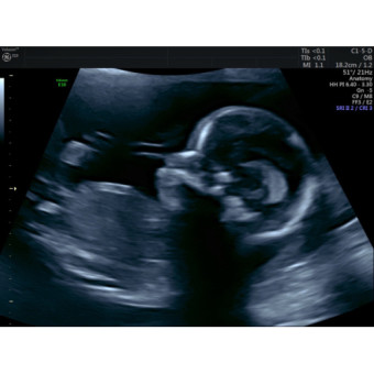 Babylist Registry Photo.