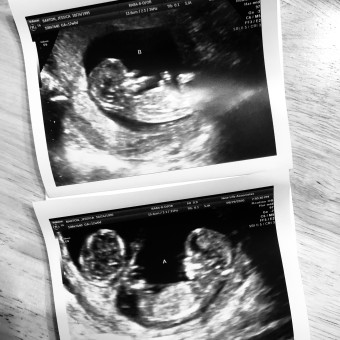 Babylist Registry Photo.