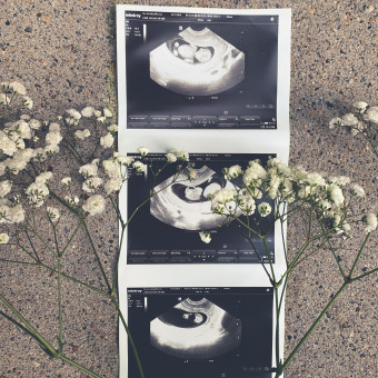 Babylist Registry Photo.