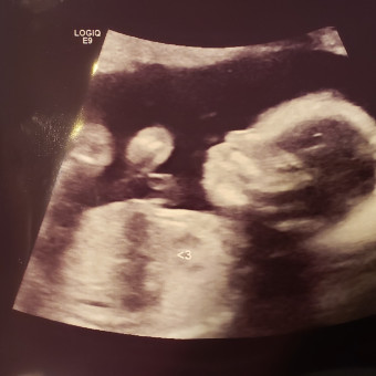 Babylist Registry Photo.