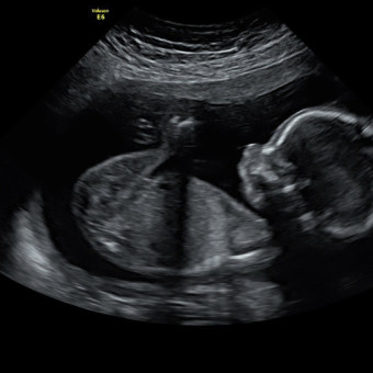 Babylist Registry Photo.