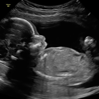 Babylist Registry Photo.