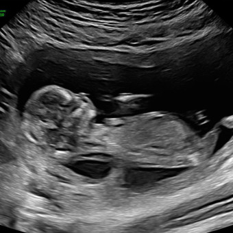 Babylist Registry Photo.
