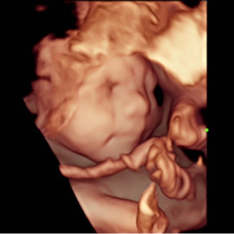 Babylist Registry Photo.