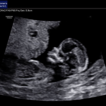 Babylist Registry Photo.