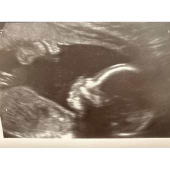 Babylist Registry Photo.