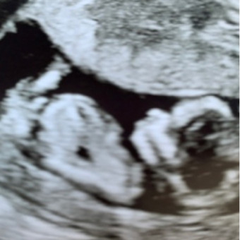 Babylist Registry Photo.