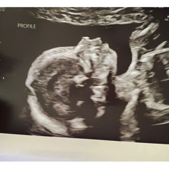 Babylist Registry Photo.
