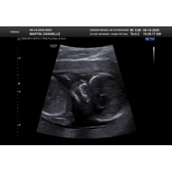 Babylist Registry Photo.