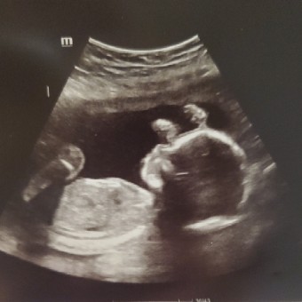 Babylist Registry Photo.