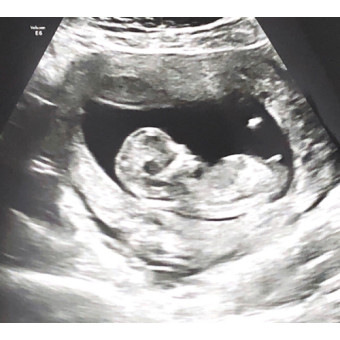 Babylist Registry Photo.