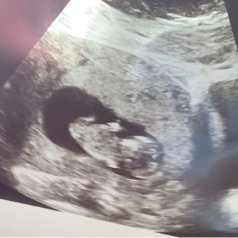 Babylist Registry Photo.