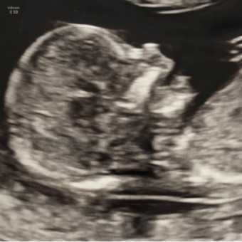 Babylist Registry Photo.