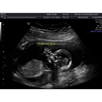 Babylist Registry Photo.