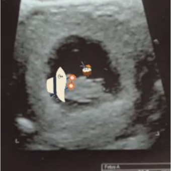 Babylist Registry Photo.