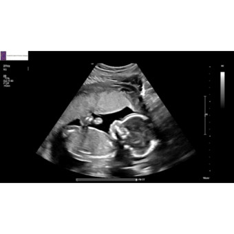 Babylist Registry Photo.