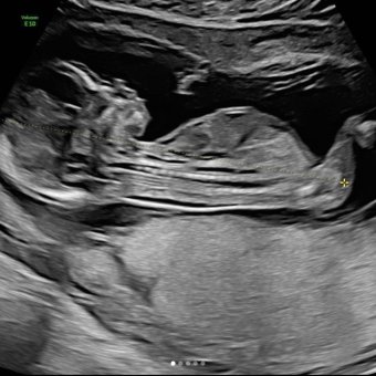 Babylist Registry Photo.