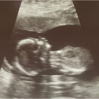 Babylist Registry Photo.