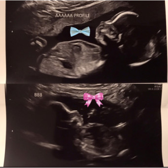 Babylist Registry Photo.