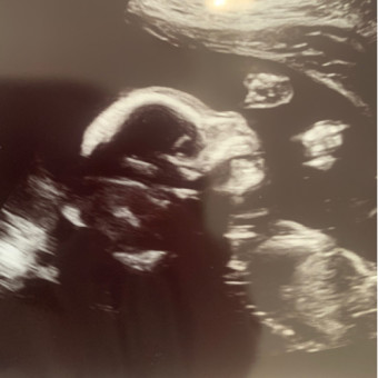 Babylist Registry Photo.