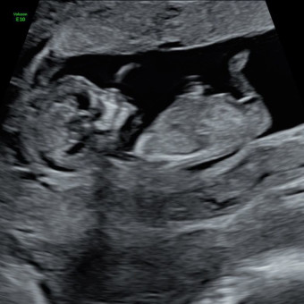 Babylist Registry Photo.