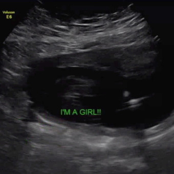 Babylist Registry Photo.