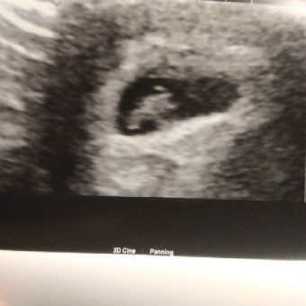Babylist Registry Photo.