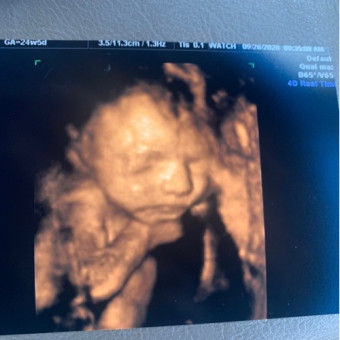 Babylist Registry Photo.