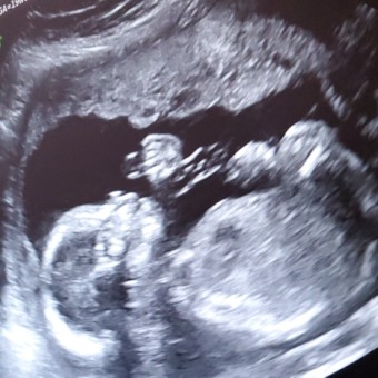 Babylist Registry Photo.